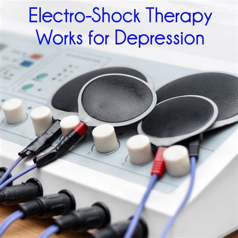 electroshock therapy for depressed